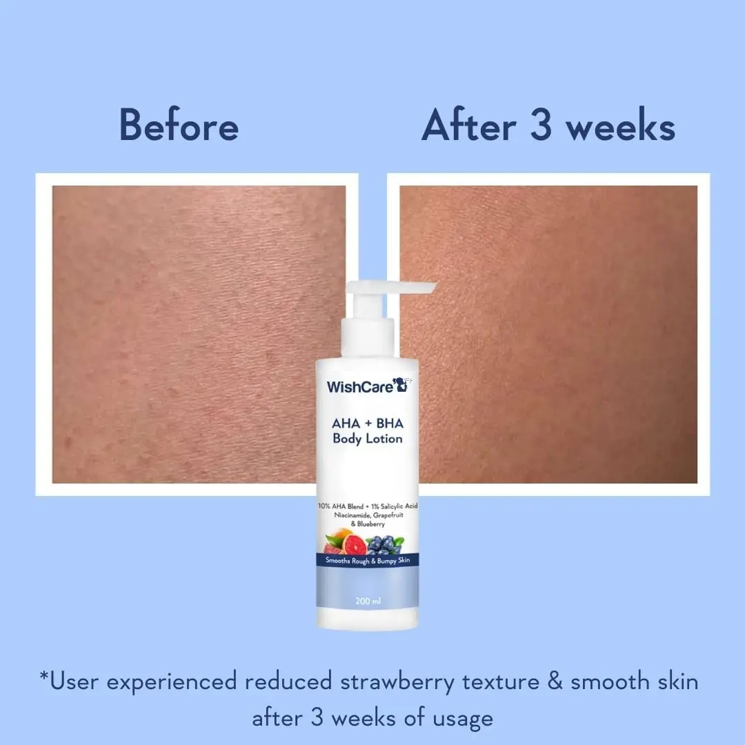 51mFFB88dkL. AC SL1080