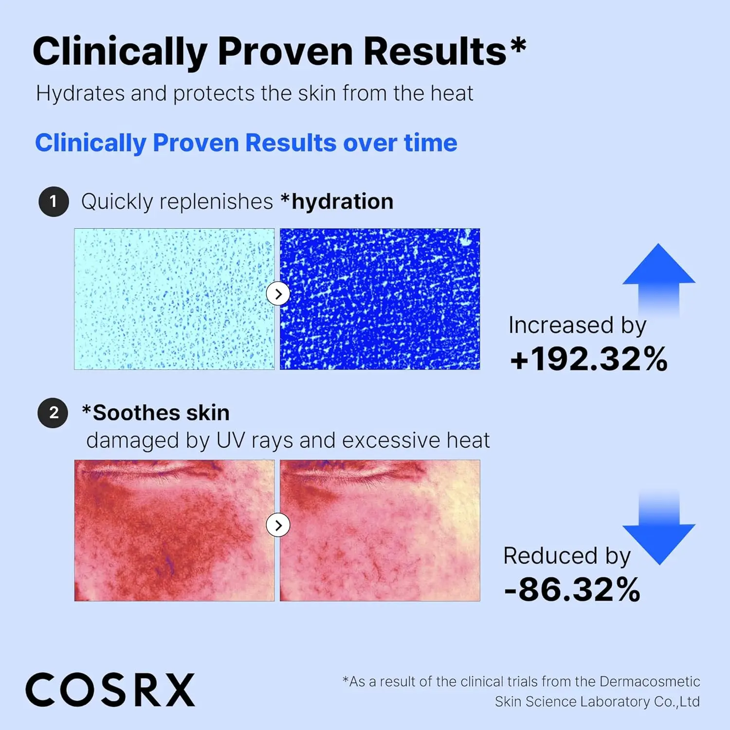 8156 2UYCkL. AC SL1500